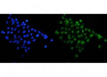 Immunofluorescent staining of FFPE human A431 cells with SIRT1 antibody (green) and DAPI nuclear sta