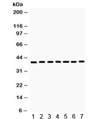 Western blot testing of rat 1) skeletal muscle, 2) kidney, 3) heart, 4) NRK, and human 5) 293, 6) He