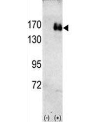 HER2 Antibody
