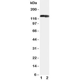 Western blot testing of COL2A1 antibody and Lane 1: rat heart; 2: rat brain tissue lysate. Predicted