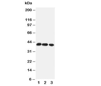 CCR4 Antibody