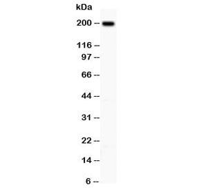 Western blot testing of Integrin beta 4 antibody and A431 lysate; Predicted molecular weight ~200 kD