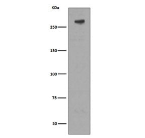 Western blot testing of human Jurkat cell lysate with M6PR antibody. Predicted molecular weight ~274