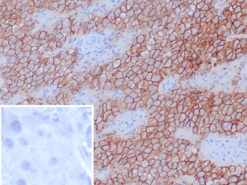 IHC staining of FFPE human tonsil tissue with Podoplanin antibody (clone D2-40). Inset: PBS used in