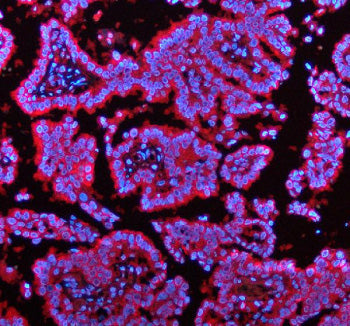 Immunofluorescent staining of ENTPD5 using anti-ENTPD5 antibody (red). ENTPD5 was detected in a para