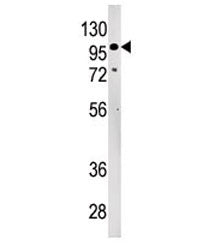 LLGL2 Antibody / HGL