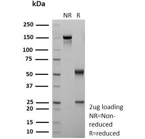 CD36 Antibody