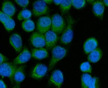 SCCPDH Antibody / Saccharopine dehydrogenase-like oxidoreductase
