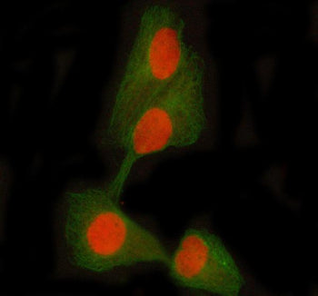Immunofluorescent staining of STAT5A/B using anti-STAT5A/B antibody (red) and anti-Beta Tubulin anti