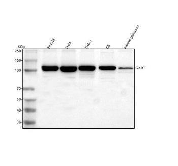 Western blot analysis of GART using anti-GART antibody. Lane 1: human HepG2 whole cell lysates, Lane