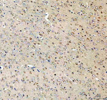 Immunohistochemical staining of SEZ6L2 using anti-SEZ6L2 antibody. SEZ6L2 was detected in a paraffin