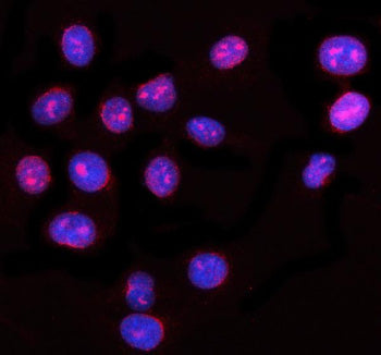 Immunofluorescent staining of NUP62 using anti-NUP62 antibody (red). NUP62 was detected in an immuno