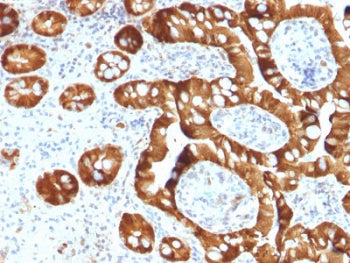 IHC staining of FFPE human small intestine with SULT1E1 antibody. Required HIER: boil tissue section