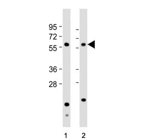 Western blot testing of human 1) HeLa and 2) HL60 cell lysate with Natriuretic peptide receptor C an