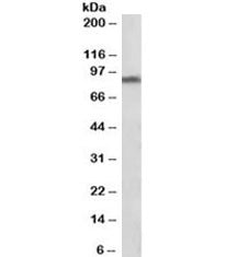 Western blot testing of human substantia nigra lysate with DAT antibody at 1ug/ml. Predicted molecul