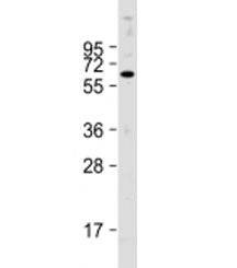PTH1R Antibody / Parathyroid Hormone Receptor