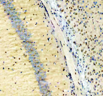 IHC staining of FFPE mouse brain tissue with NFIA antibody, HRP-secondary and DAB substrate. HIER: b
