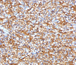 IHC testing of FFPE human pancreas with recombinant SPTBN2 antibody (clone SCNB3-2R). Required HIER: