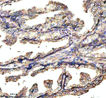 Immunohistochemical staining of GABBR2 using anti-GABBR2 antibody. GABBR2 was detected in a paraffin