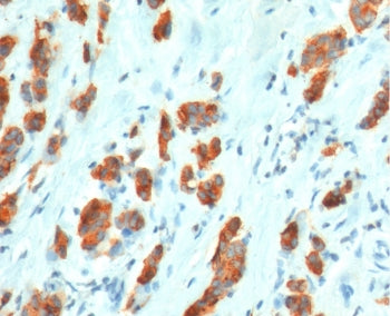 MUC1 Antibody / Mucin-1
