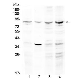 ECE1 Antibody