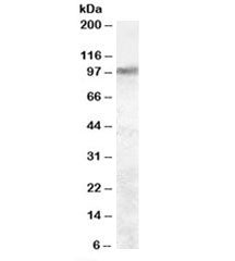 Western blot testing of rat brain lysate with Trpv2 antibody at 2ug/ml. Expected molecular weight: 8