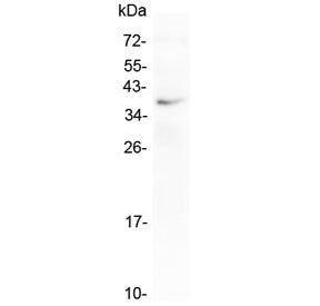 LOX-1 Antibody / OLR1 (Middle Region)