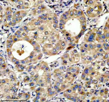IHC analysis of TOP1MT using anti-TOP1MT antibody. TOP1MT was detected in a paraffin-embedded sectio