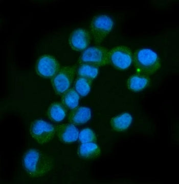 Neurofibromin Antibody / NF1