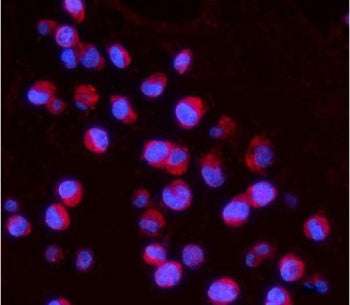 Immunofluorescent staining of FFPE human K562 cells with IL15RA antibody (red) and DAPI nuclear stai