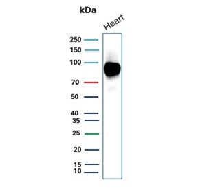 Western blot testing of human heart tissue lysate with CD36 antibody (clone CD36/7218). Expected mol