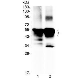 Western blot testing of 1) rat eye ball and 2) mouse eye ball lysate with Retinal S antigen antibody