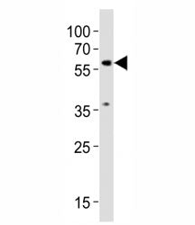 Western blot testing of SMAD2 antibody at 1:1000 dilution + NIH3T3 lysate; Predicted molecular weigh