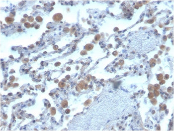 IHC staining of FFPE human lung with lung antibody. HIER: boil tissue sections in pH 9 10mM Tris wit