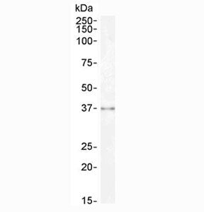 Western blot testing of human kidney lysate with Sprouty antibody at 0.3ug/ml. Predicted molecular w