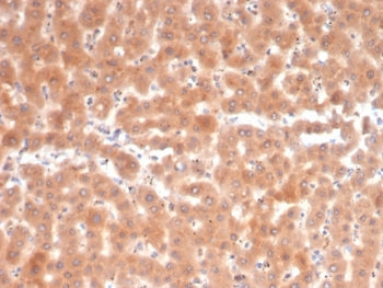 IHC staining of FFPE human liver tissue with Fibroblast Activation Protein antibody (clone FAP/4853)