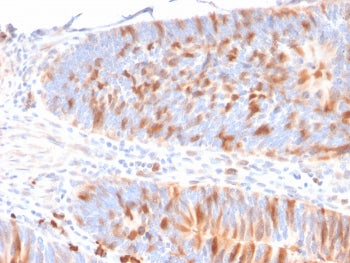 IHC staining of FFPE human colon with Myoglobin antibody (CPTC-MBD1-1). HIER: boil tissue sections i