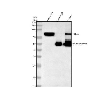 Western blot testing of PKC beta antibody and lysate from 1: rat brain; 2: mouse brain; 3: human COL