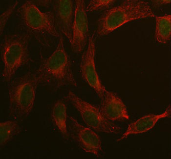 Immunofluorescent staining of MAN2C1 using anti-MAN2C1 antibody (green) and anti-Beta Tubulin antibo