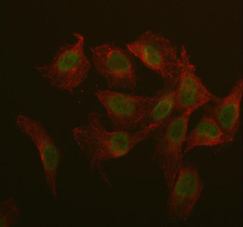 Immunofluorescent staining of IQCE using anti-IQCE antibody (green) and anti-Beta Tubulin antibody (