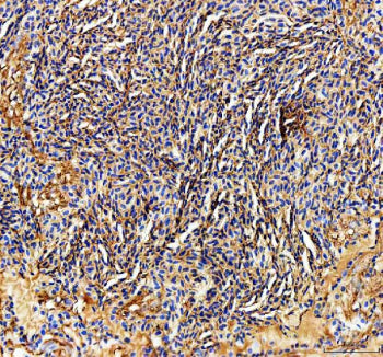 IHC staining of FFPE zebrafish spleen tissue with Zebrafish Ckm antibody. HIER: boil tissue sections