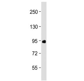 Factor XIIIa Antibody / F13A1 (N-Terminal Region)