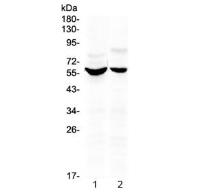 Western blot testing of human 1) HeLa and 2) HepG2 cell lysate with KPNA2 antibody at 0.5ug/ml. Pred