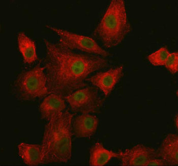 Immunofluorescent staining of SUPT20H using anti-SUPT20H antibody (green) and anti-Beta Tubulin anti