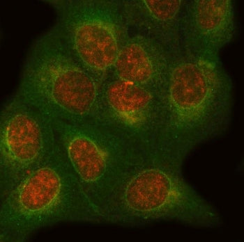 ONECUT1 Antibody / One cut homeobox 1 / HNF6