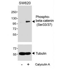 Western blot testing of extracts from SW620 cells, untreated or treated with Calyculin A, (100nM, 30