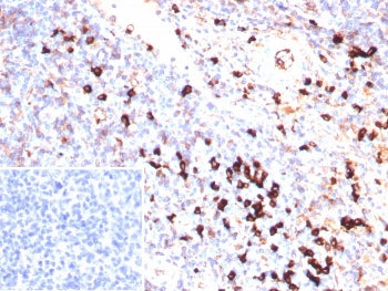 IHC staining of FFPE human tonsil tissue with recombinant Lambda Light Chain antibody (clone IGL/939