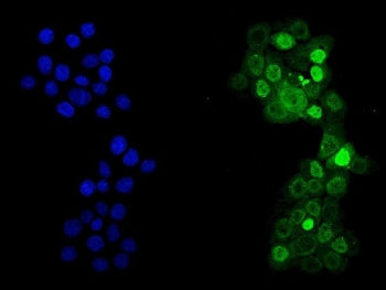p53 Antibody
