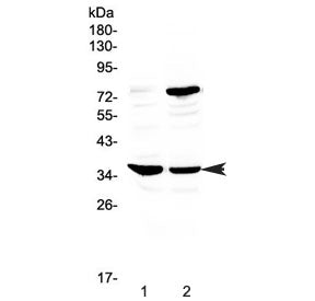 Western blot testing of rat 1) spleen and 2) thymus tissue with CD23 antibody at 0.5ug/ml. Expected