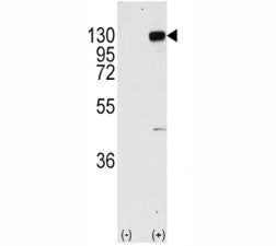 FGFR1 Antibody